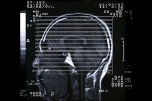 漢方愛好者必見！自然な治療法で風邪やストレスを撃退する方法